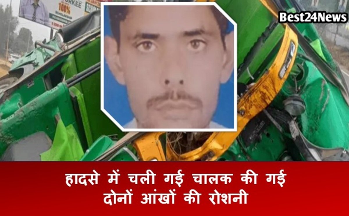 हादसे में चली गई चालक की गई दोनों आंखों की रोशनी, एक माह बाद मामला दर्ज