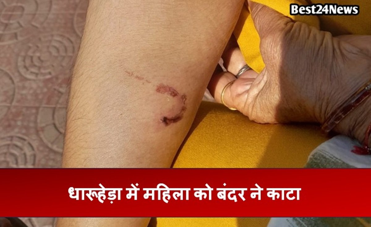 बदरों का आंतक, फिर एक महिला बनी शिकार