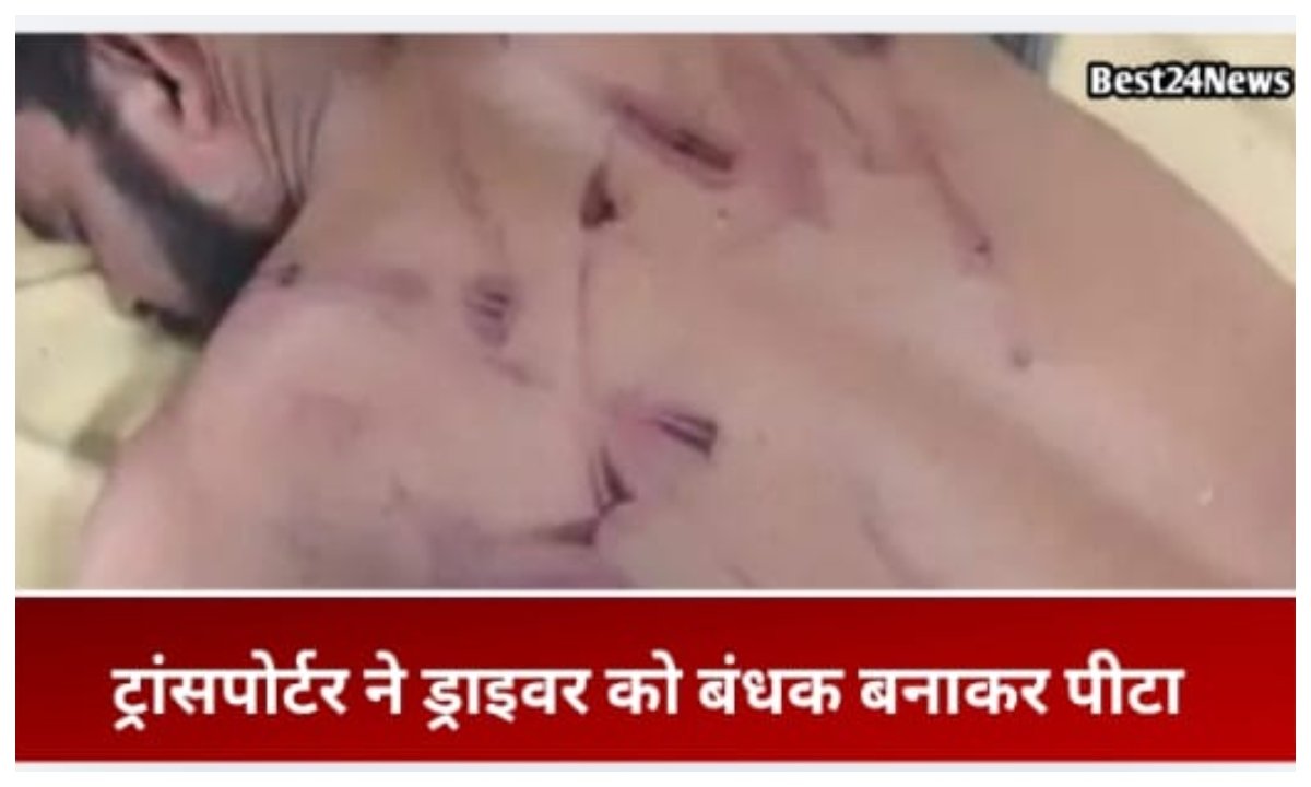 ट्रांसपोर्टर ने ड्राइवर को बंधक बनाकर पीटा