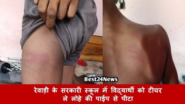 रेवाड़ी के सरकारी स्कूल में विद्यार्थी को टीचर ने लोहे की पाईप से पीटा