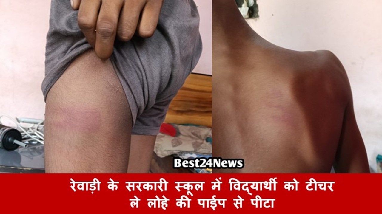 रेवाड़ी के सरकारी स्कूल में विद्यार्थी को टीचर ले लोहे की पाईप से पीटा
