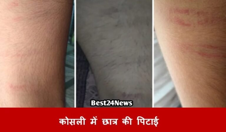 रेवाड़ी में 9वीं के छात्र की बेरहमी से पिटाई